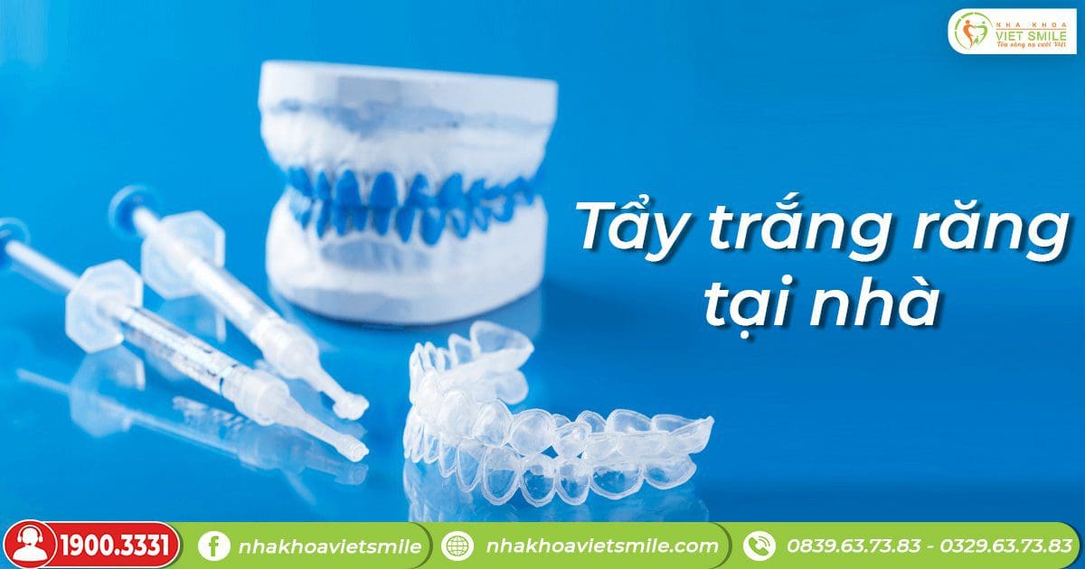 Tẩy trắng răng là gì? Các phương pháp tại nhà và tại nha khoa 2 Máng tẩy trắng răng tại nhà