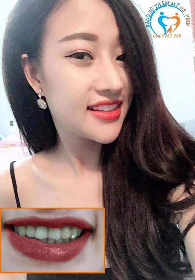 Nha khoa VIET SMILE