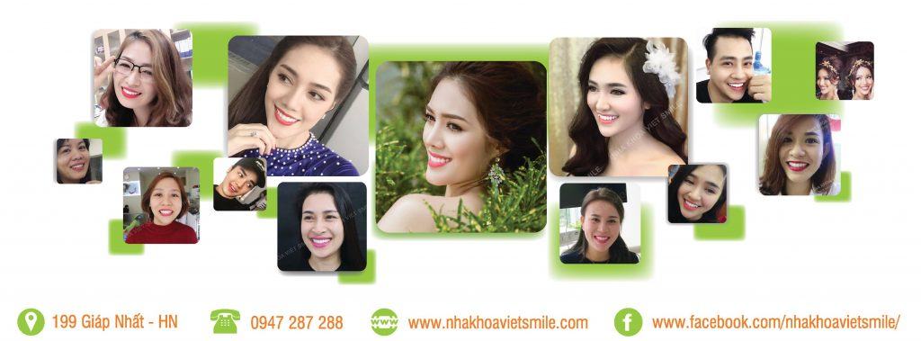 https://nhakhoavietsmile.com