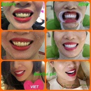 Nha khoa VIET SMILE