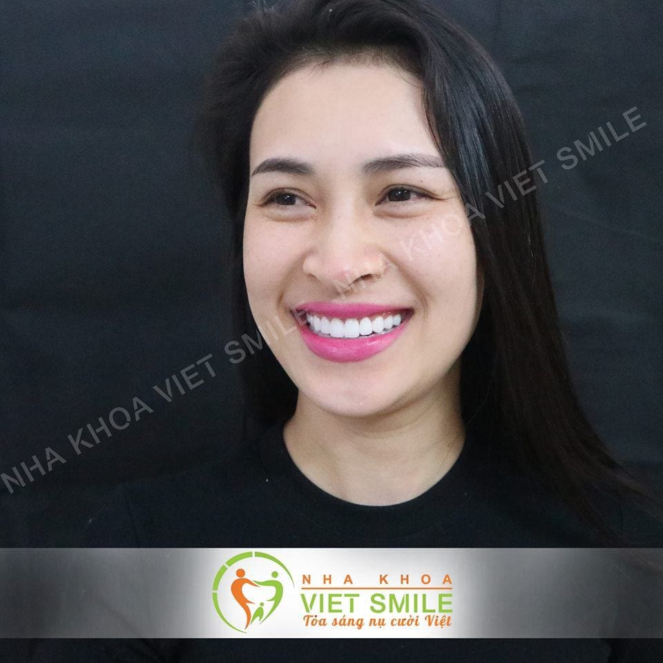 Nha khoa VIET SMILE