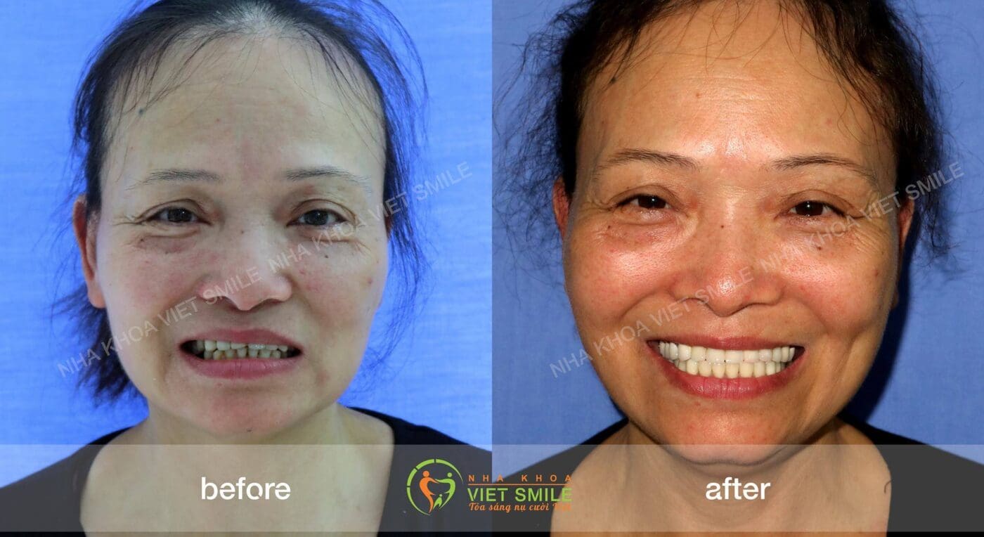 Nha khoa VIET SMILE