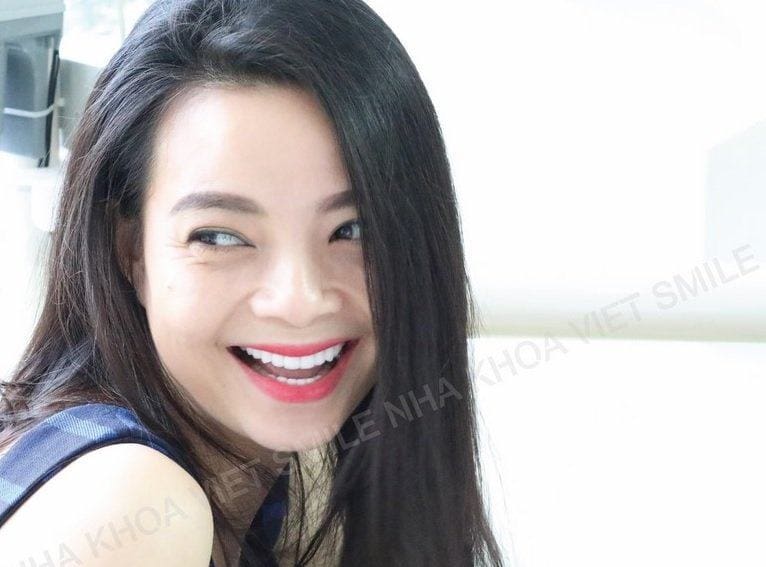 Nha khoa VIET SMILE