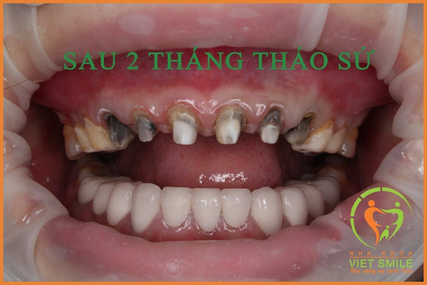 Nha khoa VIET SMILE