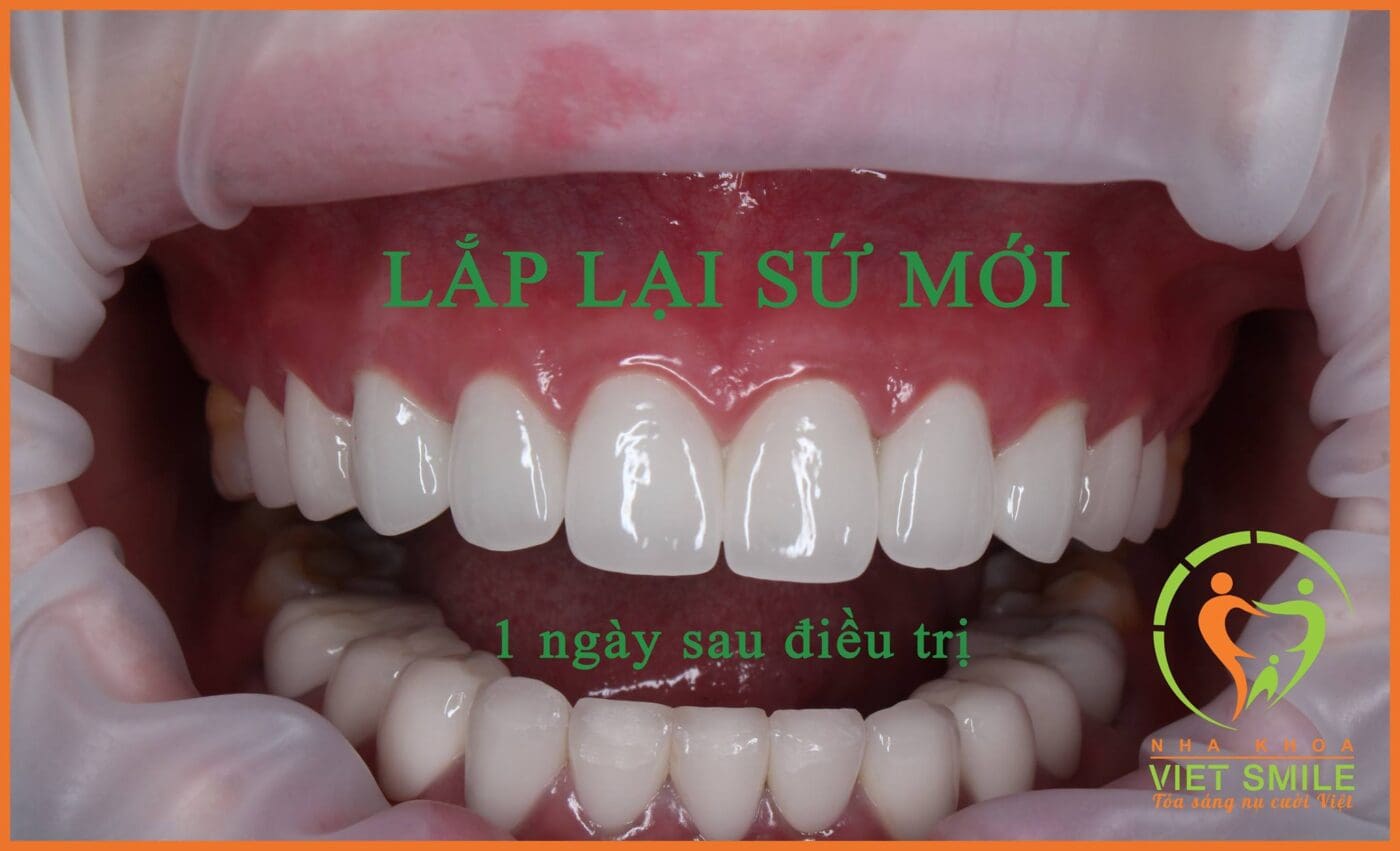 Nha khoa VIET SMILE