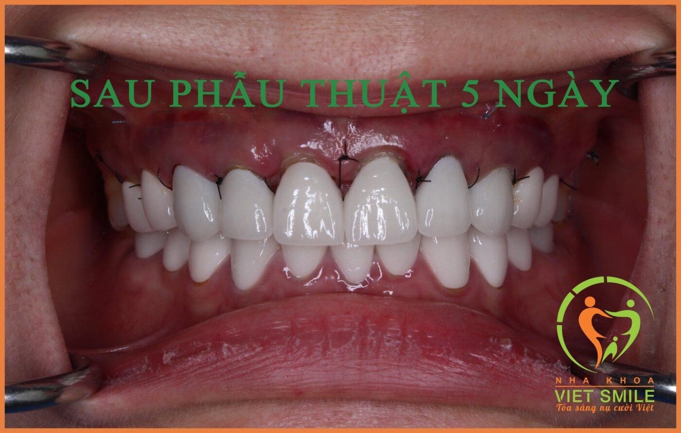 Nha khoa VIET SMILE