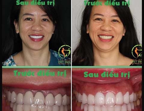 Nha khoa VIET SMILE