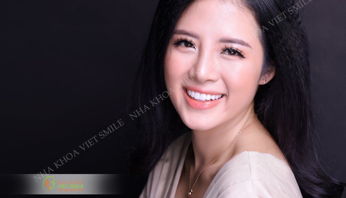 niềng răng là gì? lợi ích của niềng răng là gì? 2 Nieng rang nha khoa viet smile