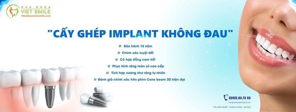 Vietsmile implant nha khoa