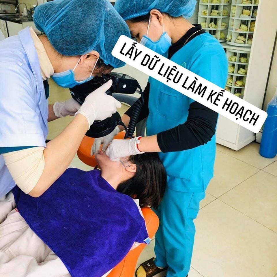 các trường hợp nên niềng răng ngay 3 Vietsmile lay du lieu chinh nha