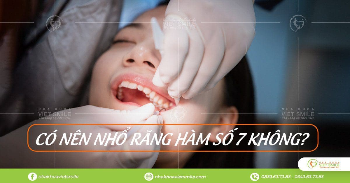 có nên nhổ răng hàm số 7 không? 1 Co nen nho rang ham so 7