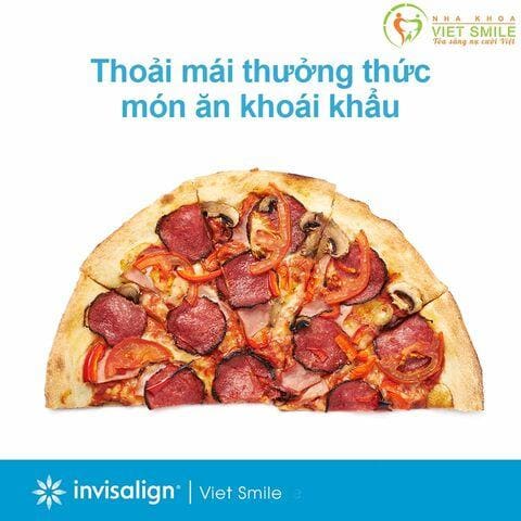 Kinh nghiệm niềng răng trong suốt - invisalign hiệu quả 7 Vietsmile kinh nghiem nieng rang trong suot hieu qua 2