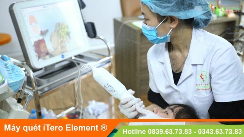 kinh nghiệm niềng răng trong suốt - invisalign hiệu quả 5 Vietsmile kinh nghiem nieng rang trong suot hieu qua cao 1