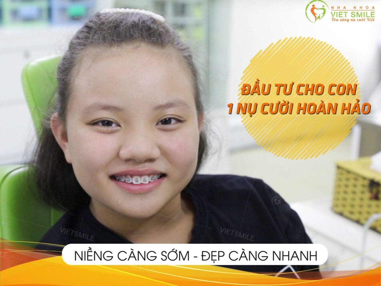 Review niềng răng đẹp mỗi ngày - loạt ảnh tiếp thêm động lực cho bạn 16 Hình ảnh niềng răng