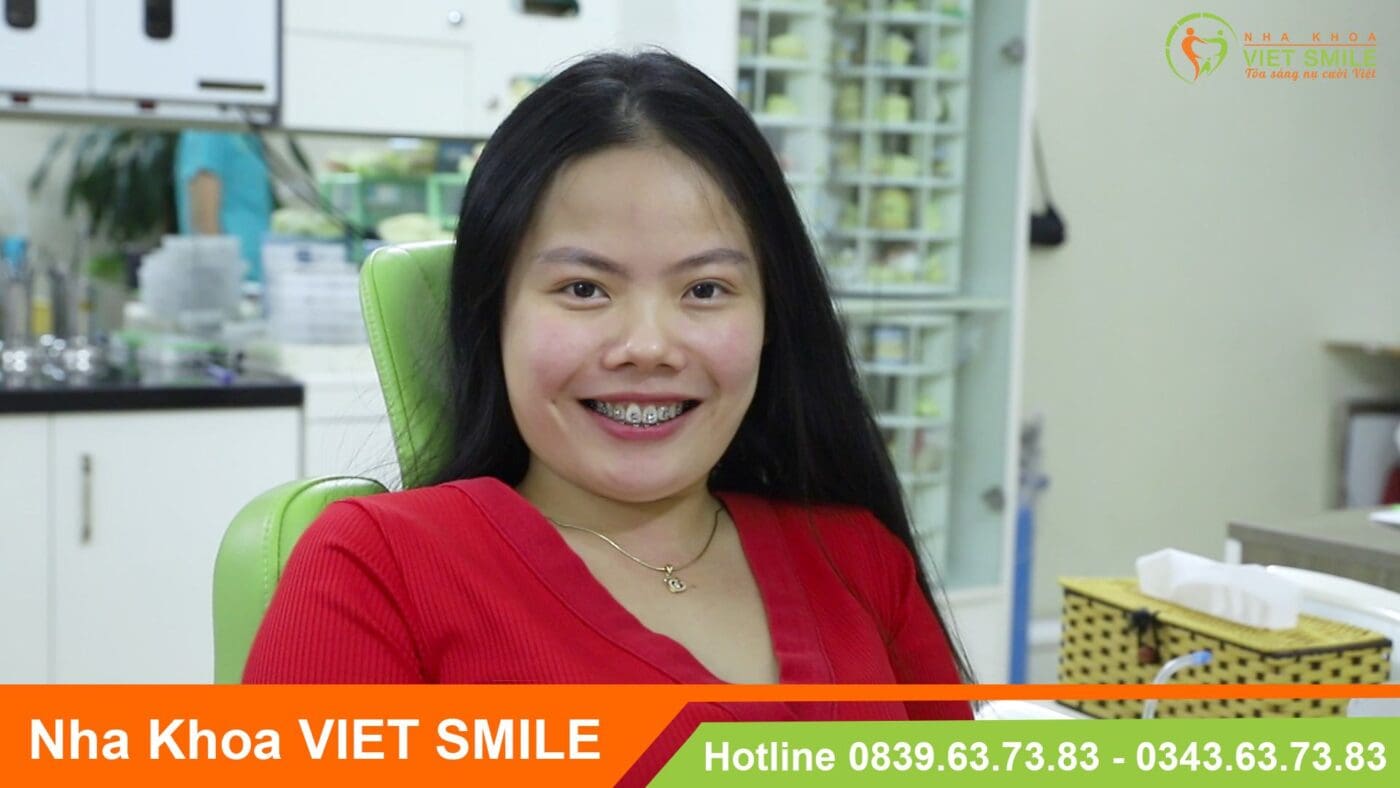 Review niềng răng đẹp mỗi ngày - loạt ảnh tiếp thêm động lực cho bạn 10 Niềng răng an toàn cùng bác sĩ giỏi
