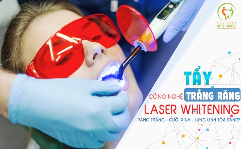 Tẩy trắng răng công nghệ Laser Whitening