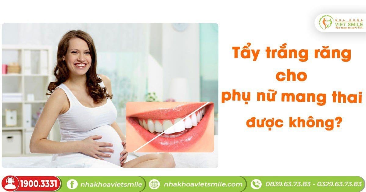 Chị em, phụ nữ mang thai có tẩy trắng răng được không?