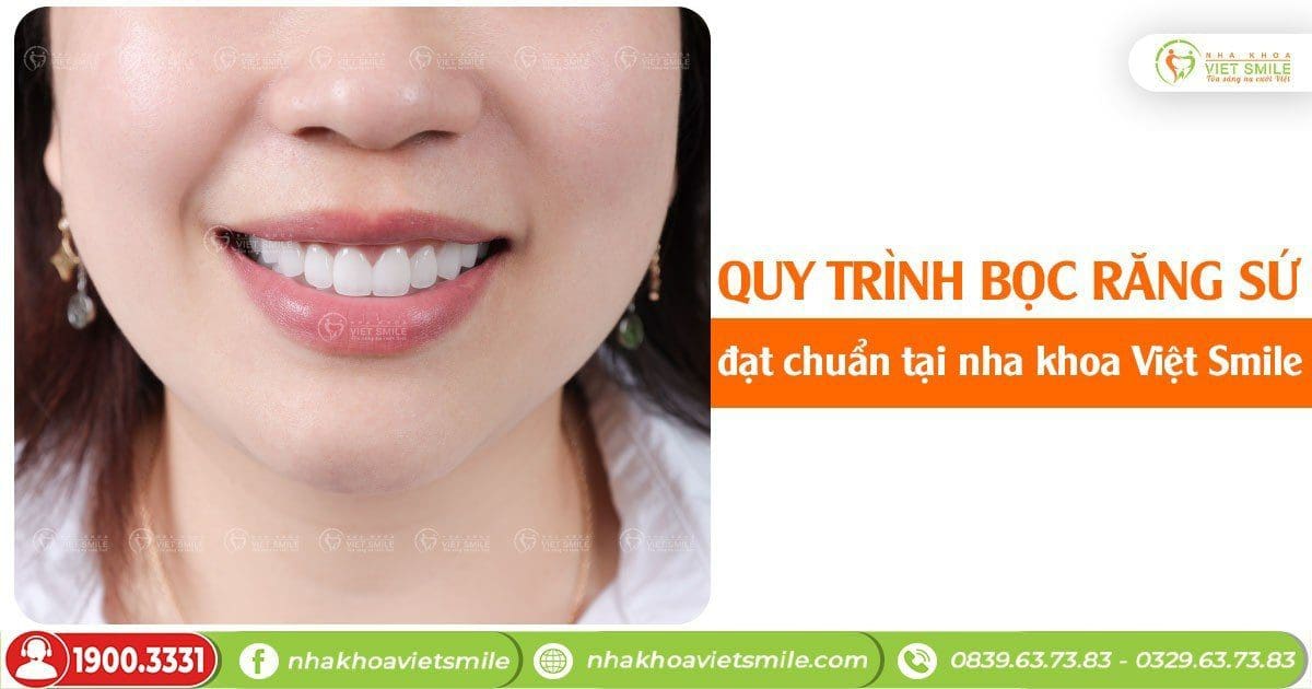 Quy trình bọc răng sứ đạt chuẩn tại nha khoa Việt Smile