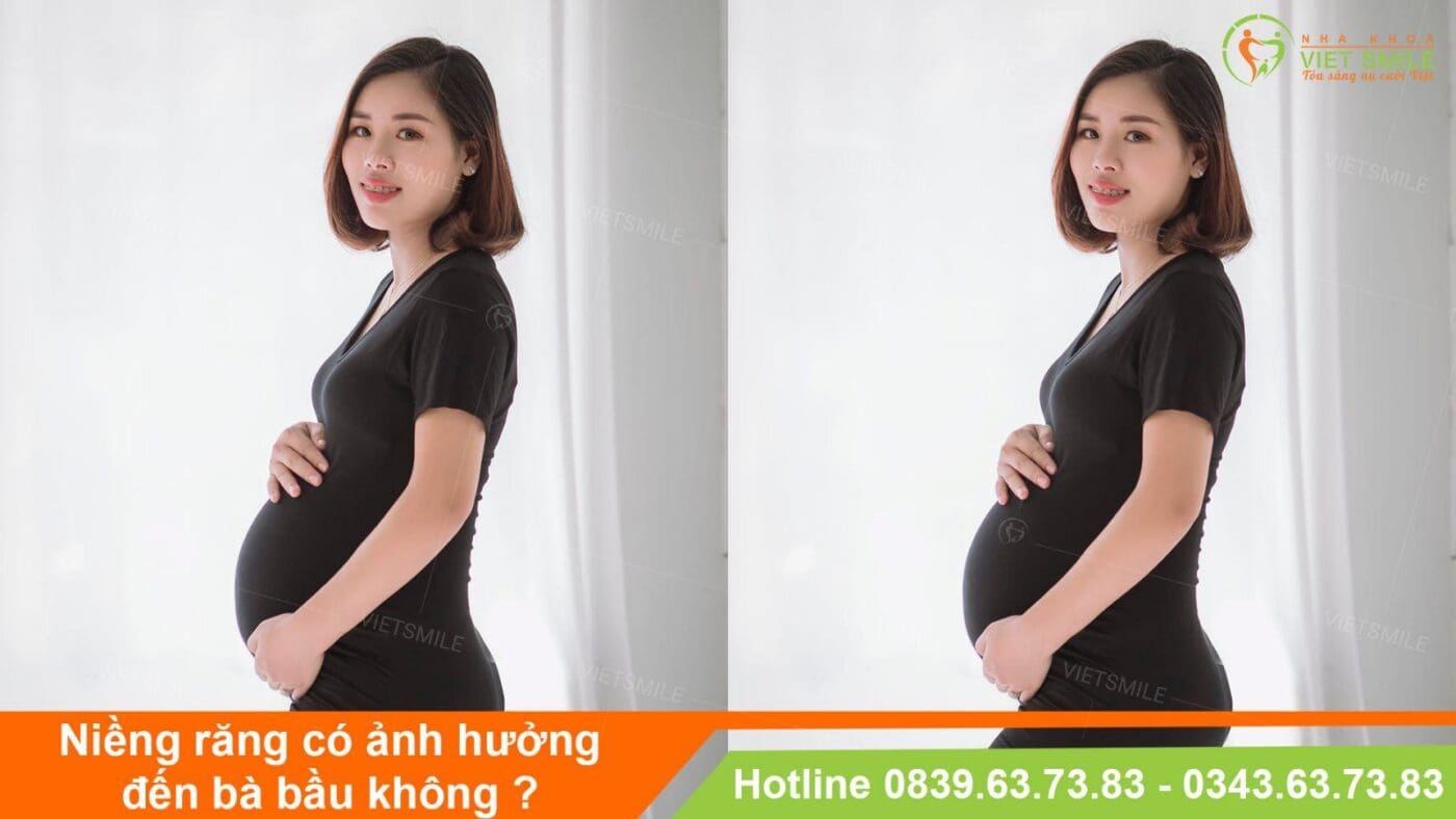 niềng răng có ảnh hưởng đến việc mang thai không - những lưu ý quan trọng 1 Vietsmile nieng rang co anh huong den viec mang thai khong