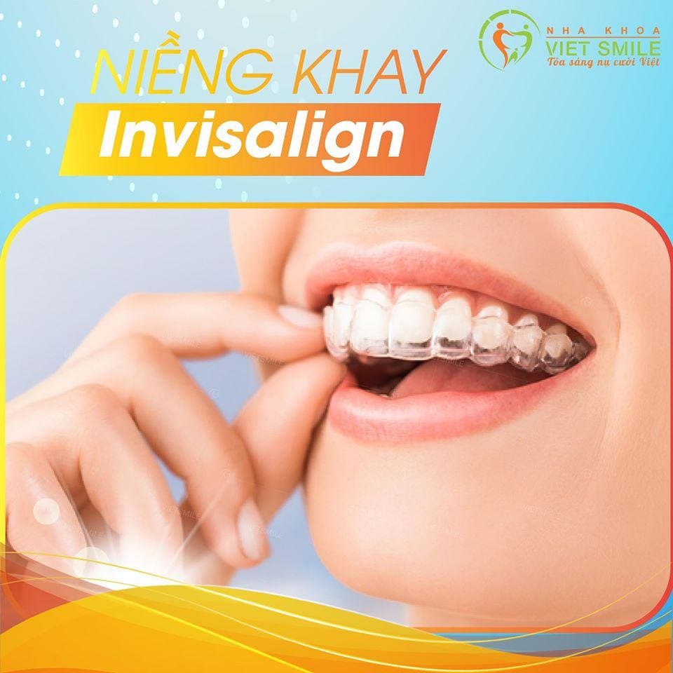 tìm hiểu về niềng răng trong suốt tại nha khoa việt smile 1 Vietsmile tim hieu ve nieng rang trong suot tai nha khoa viet smile