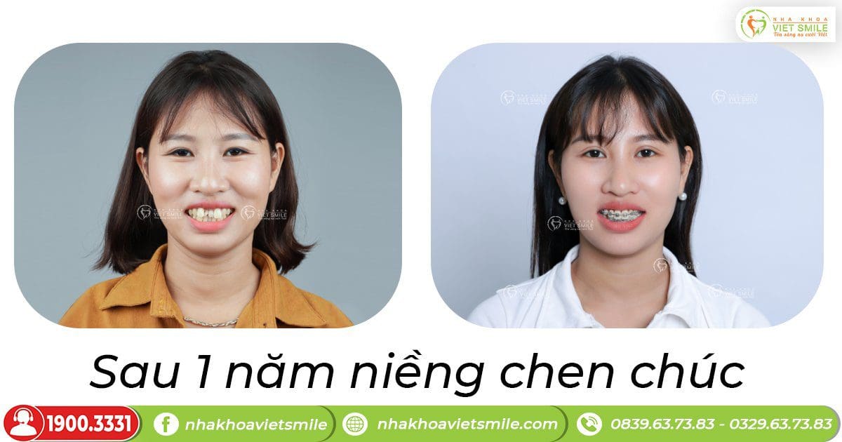 Nha khoa VIET SMILE