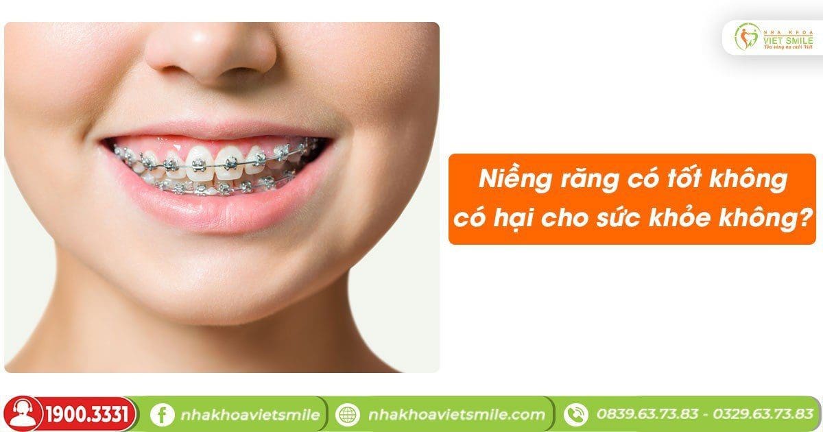 Niềng răng có tốt không, có hại cho sức khỏe không?