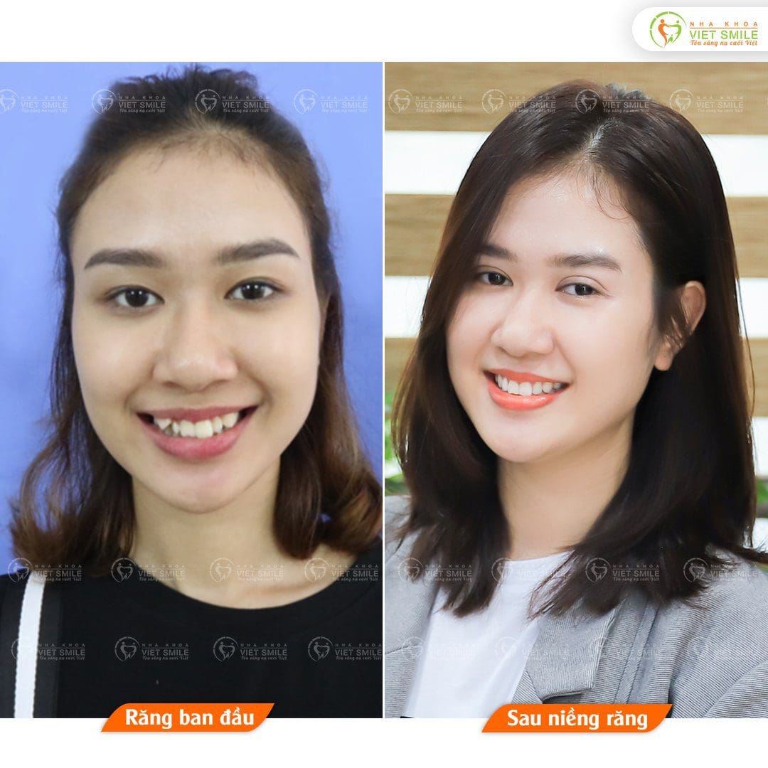 Nha khoa VIET SMILE