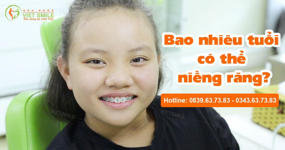 Tuổi nào trẻ em có thể niềng răng? 1 Tuoi nao nieng rang