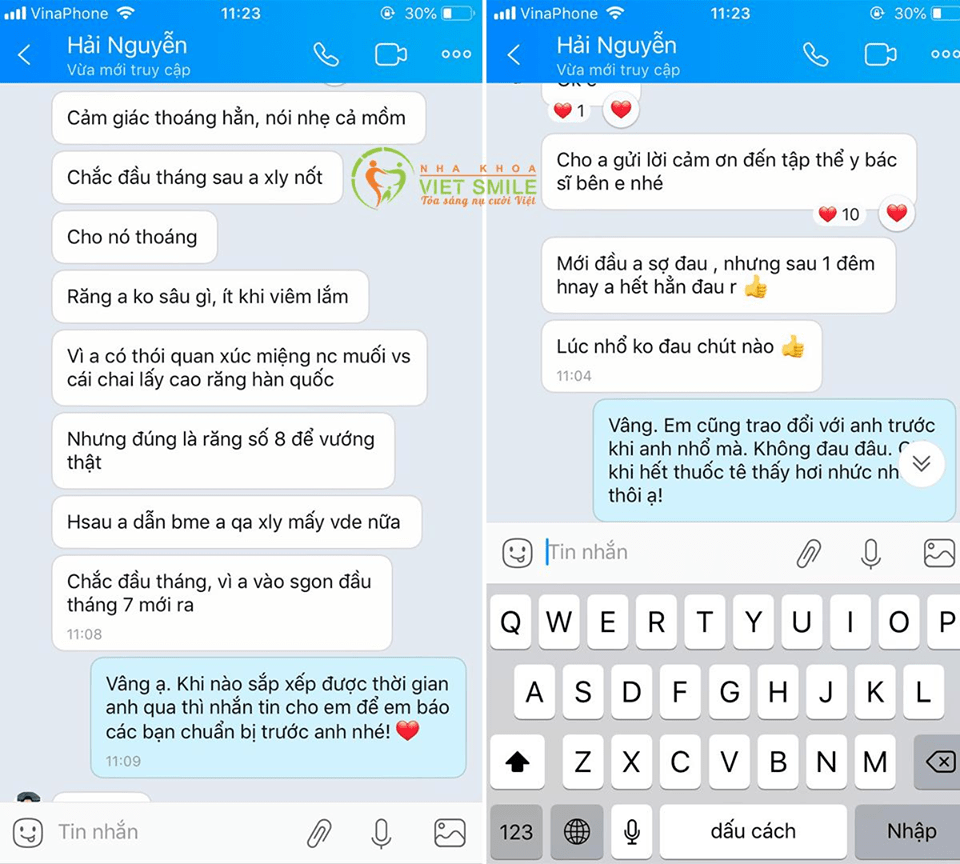 Nhổ răng khôn 21 Nhổ răng không đau