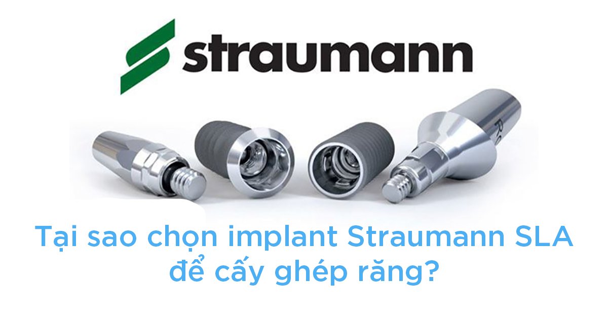 Tại sao chọn implant Straumann SLA để cấy ghép răng?