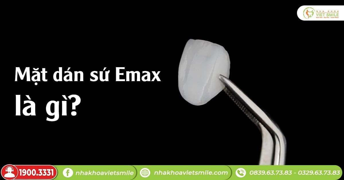 Mặt dán sứ Emax là gì?