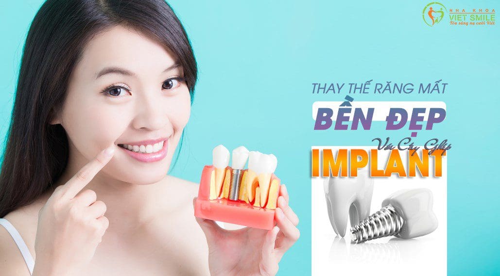 trồng răng giả cố định với implant kontact s 1 Implant kontact s