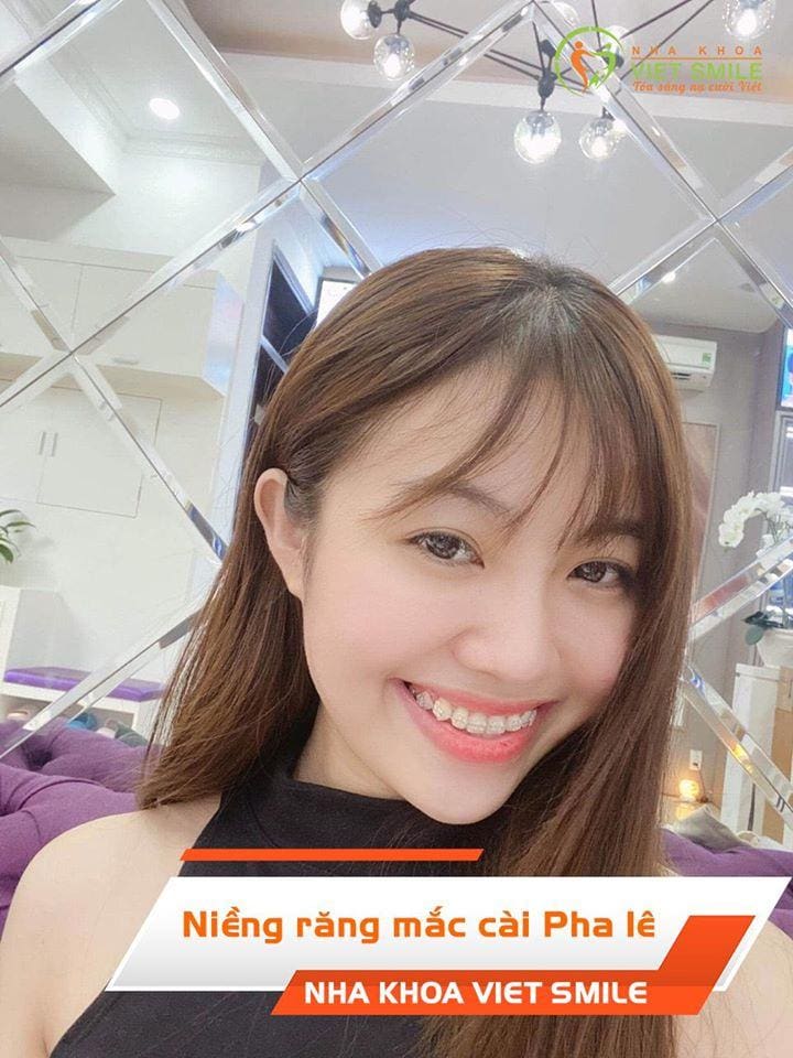 mắc cài pha lê tiêu chuẩn jiscop cấp độ 1 1 Mac cai pha le