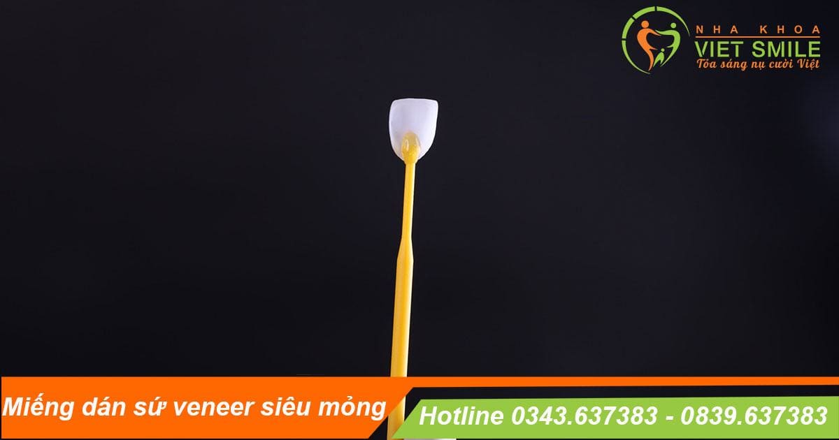 mặt dán sứ veneer laminate ips e.max được sản xuất như thế nào? 2 Emax veneer