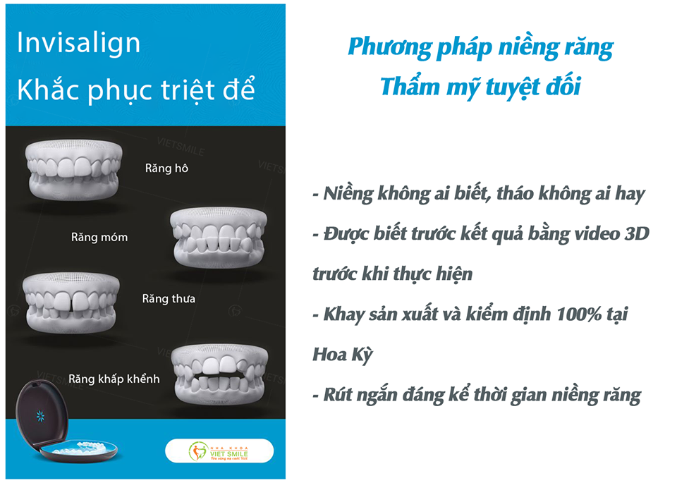 Vì sao invisalign được gọi là công nghệ niềng răng thông minh? 2 Mang trong suot