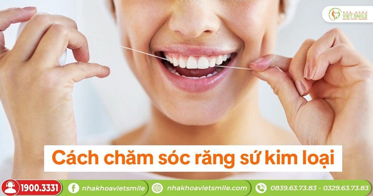 Cách chăm sóc răng sứ kim loại