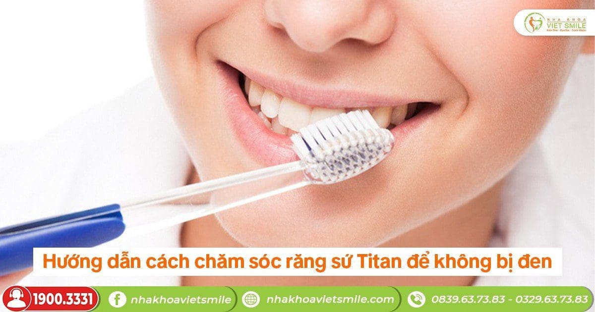 Hướng dẫn cách chăm sóc răng sứ titan để không bị đen