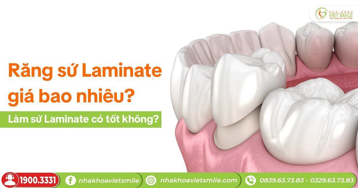 Răng sứ Laminate giá bao nhiêu? Làm sứ Laminate có tốt không?