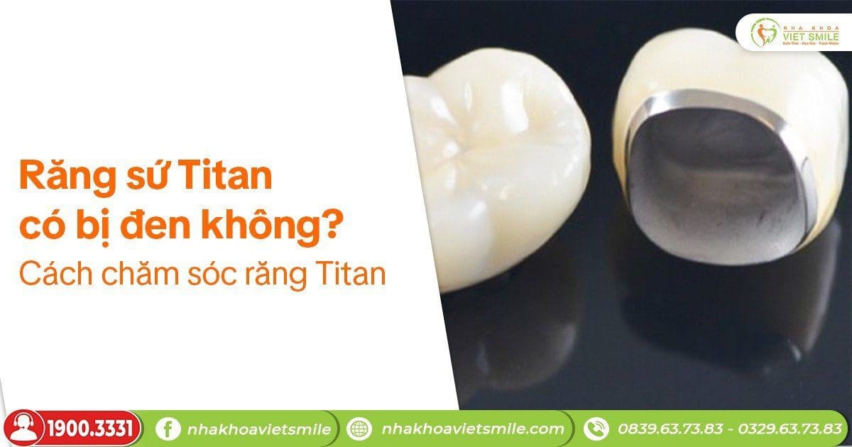 Răng sứ titan có bị đen không? Cách chăm sóc răngtitan