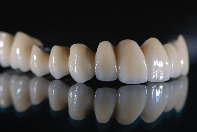 Cách khắc phục răng sứ titan bị đen