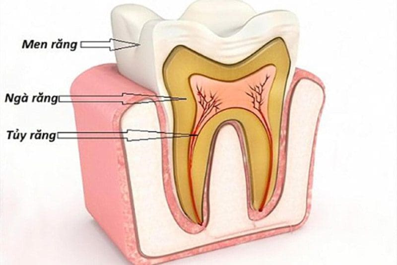 những biến chứng của viêm tủy răng 2 Tuy rang
