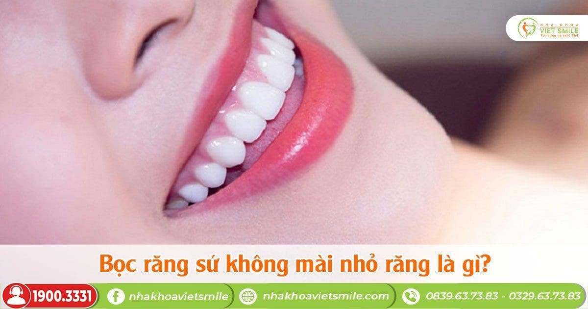 Bọc răng sứ không mài nhỏ răng là gì?