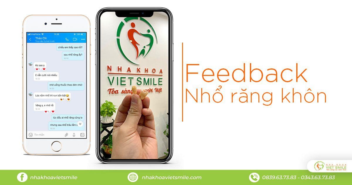 đẩy nhanh quá trình lành thương sau nhổ răng khôn 4 Nhổ răng không đau