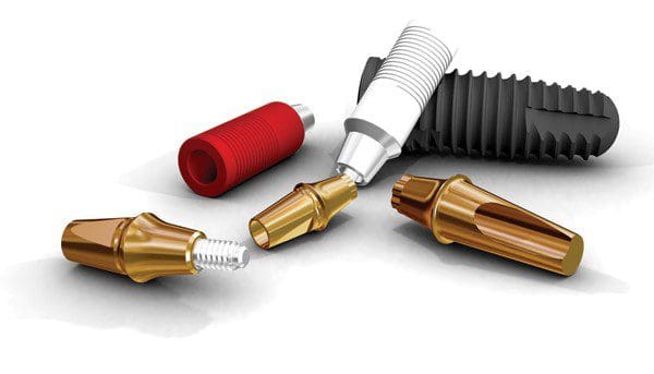 Nên lựa chọn trụ implant hàn quốc hay trụ implant mỹ 1 Tru implant han quoc hay tru i mplant my