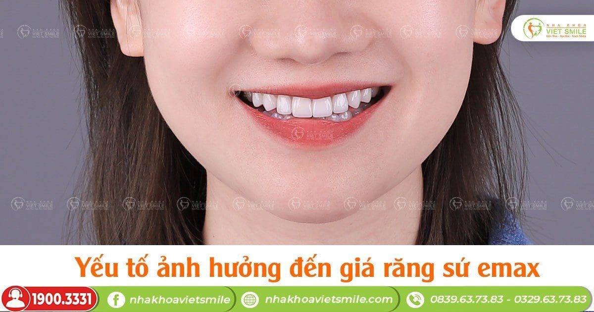 Yếu tố ảnh hưởng đến giá răng sứ emax