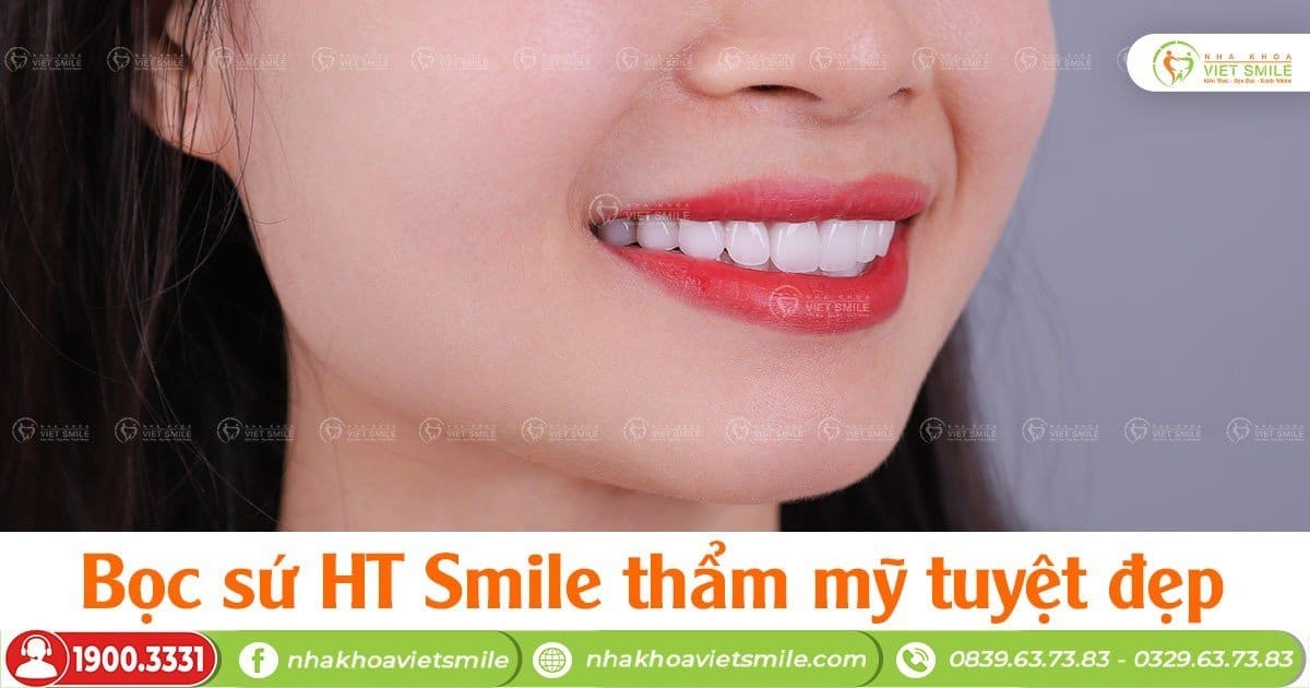Bọc sứ HT Smile thẩm mỹ tuyệt đẹp cùng nha khoa Việt Smile