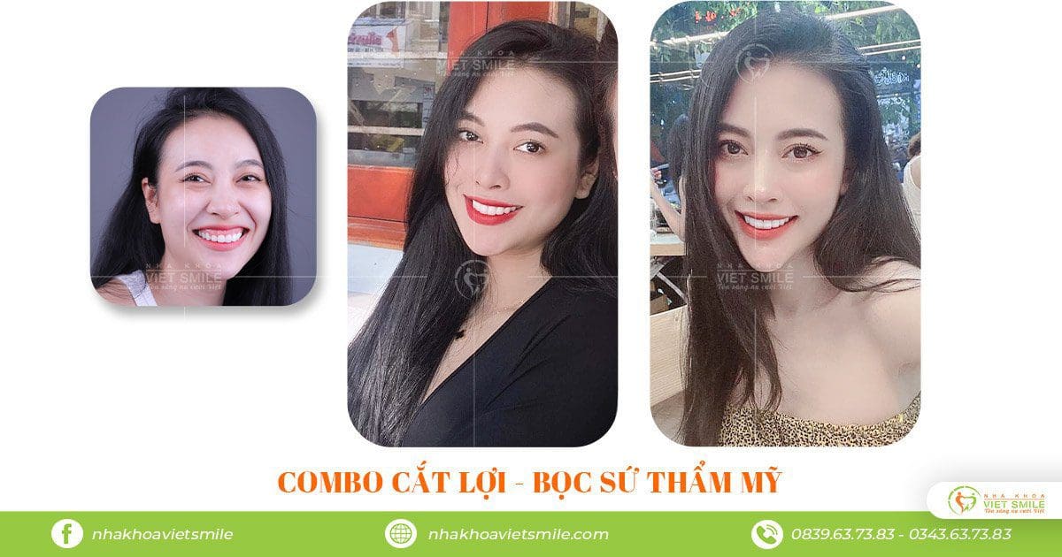 Nha khoa VIET SMILE