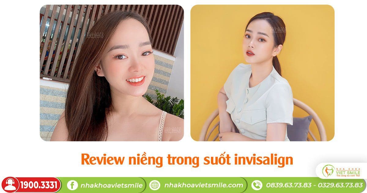  niềng răng trong suốt invisalign