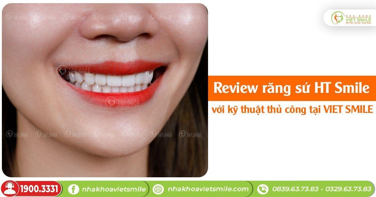 Review răng sứ HT Smile với kỹ thuật thủ công tại VIET SMILE