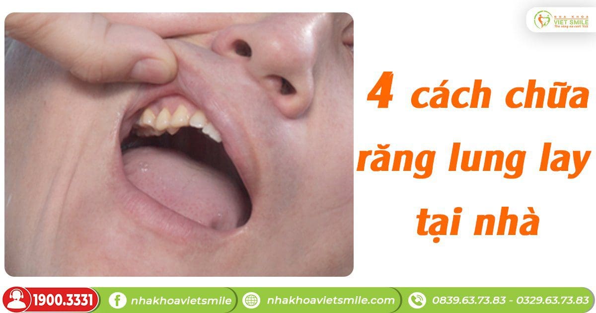 4 cách chữa răng lung lay tại nhà